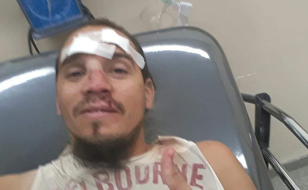 El joven herido por derrumbe en El Espigón se encuentra en buen estado y fuera de peligro