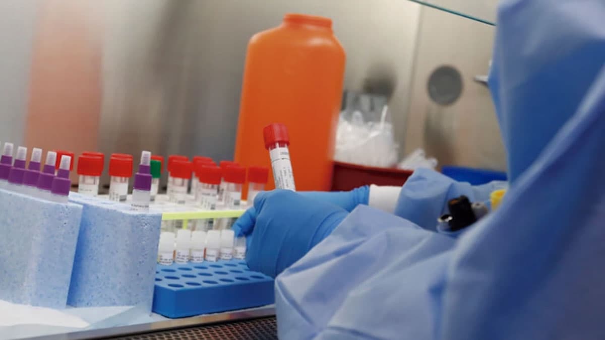 Cuatro fallecidos y 258 nuevos casos de coronavirus en Rio Negro